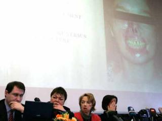 スクリーンは術前の状態