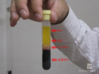 分離後のスピッツ