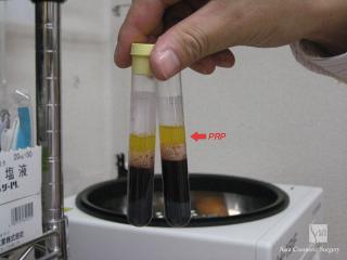 PPP破棄後のスピッツ