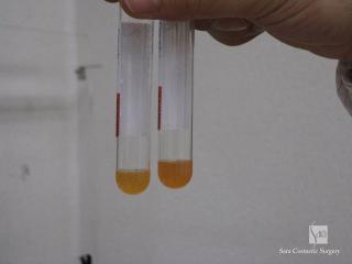 塩化カルシウムと混ぜる