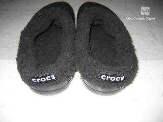 クロックスのmammoth