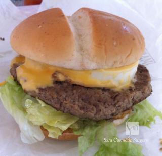 ビバリーヒルズバーガー