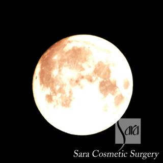 スーパームーン