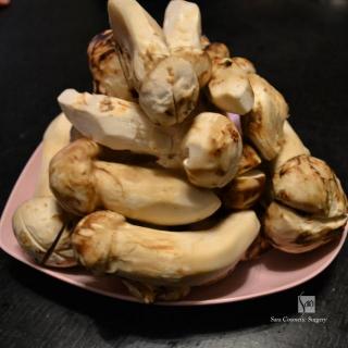 秋の味覚の王様松茸！